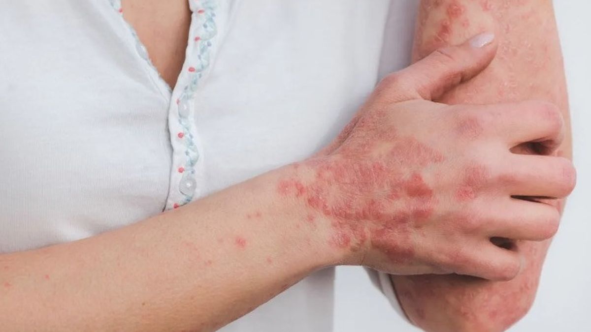 gejala autoimun adalah, penyakit autoimun, lupus, rheumatoid arthritis, tiroiditis, kesehatan, deteksi dini, sistem kekebalan, nyeri sendi