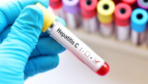pengobatan hepatitis C, hepatitis C, virus hepatitis C, obat DAA, sofosbuvir, velpatasvir, kesehatan hati, deteksi dini, skrining hepatitis