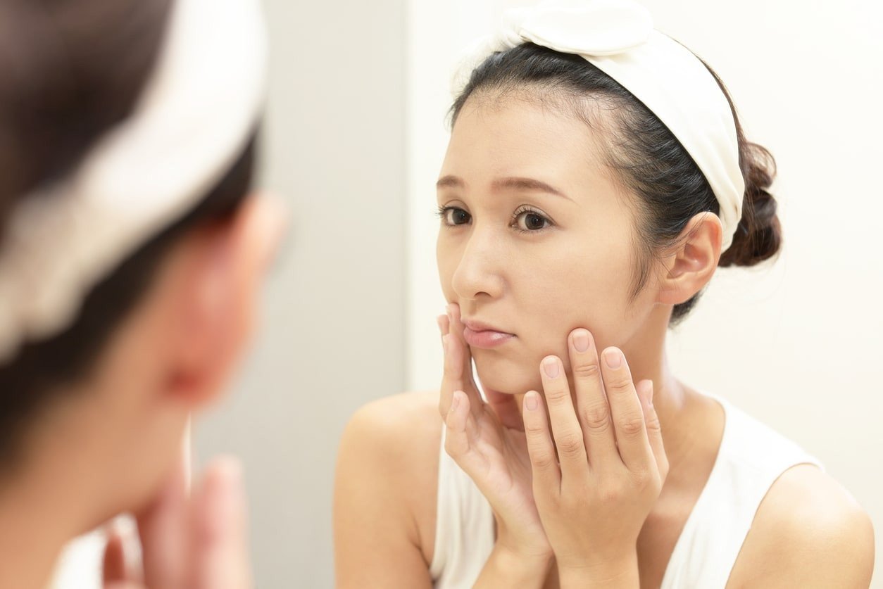 perawatan melasma, melasma, kulit cerah, skincare, sunscreen, laser terapi, chemical peel, tranexamic acid, dermatologi